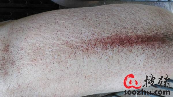 附红体和嗜血杆菌混合感染 多关注猪群健康|疫