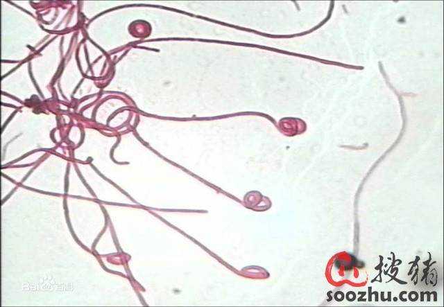 一种不常见的疾病-猪舌部溃疡